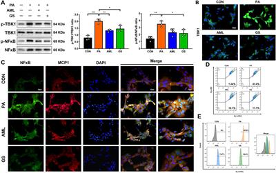 Gentiana scabra Restrains Hepatic Pro-Inflammatory Macrophages to Ameliorate Non-Alcoholic Fatty Liver Disease